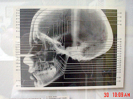 The headshot -- for bracing famous faces.